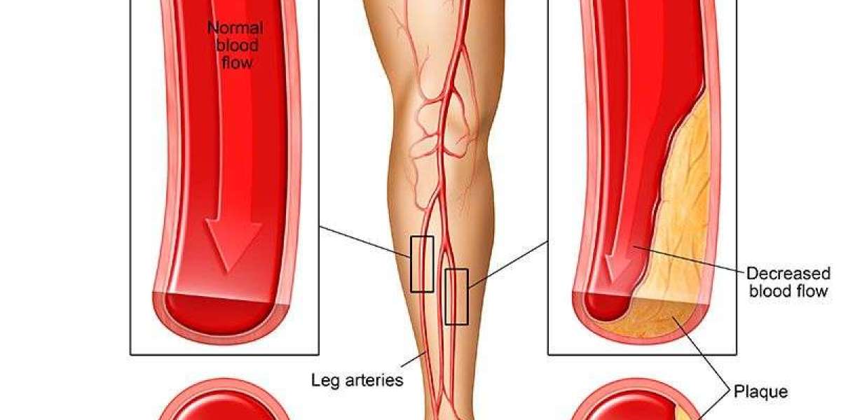 Leg Pain - Symptoms, Causes, Diagnosis & Best Treatment