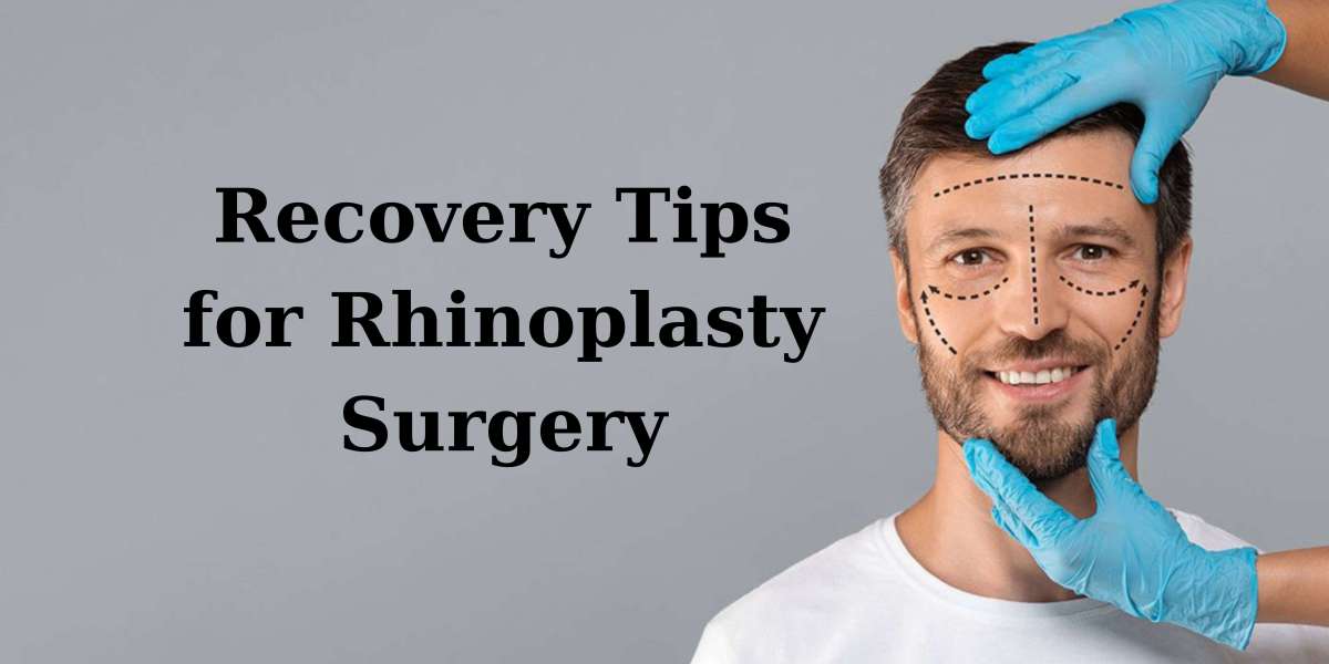 Rhinoplasty for Nasal Hump Correction