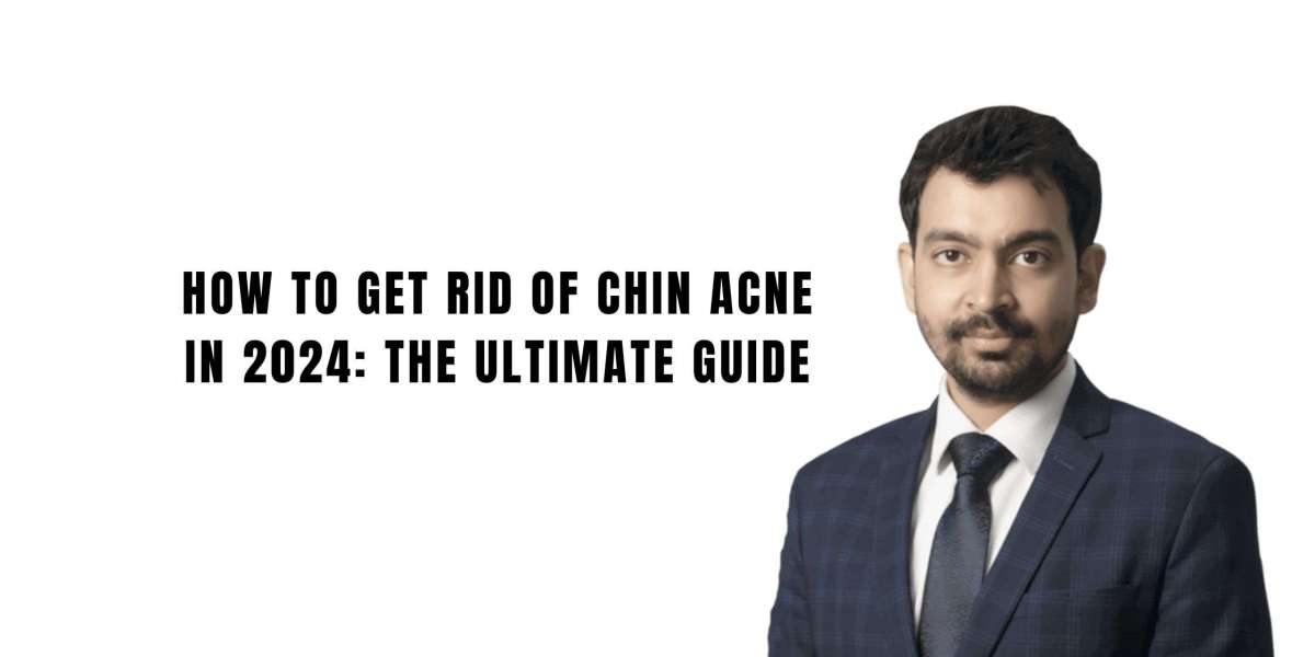 How To Get Rid Of Chin Acne In 2024: The Ultimate Guide
