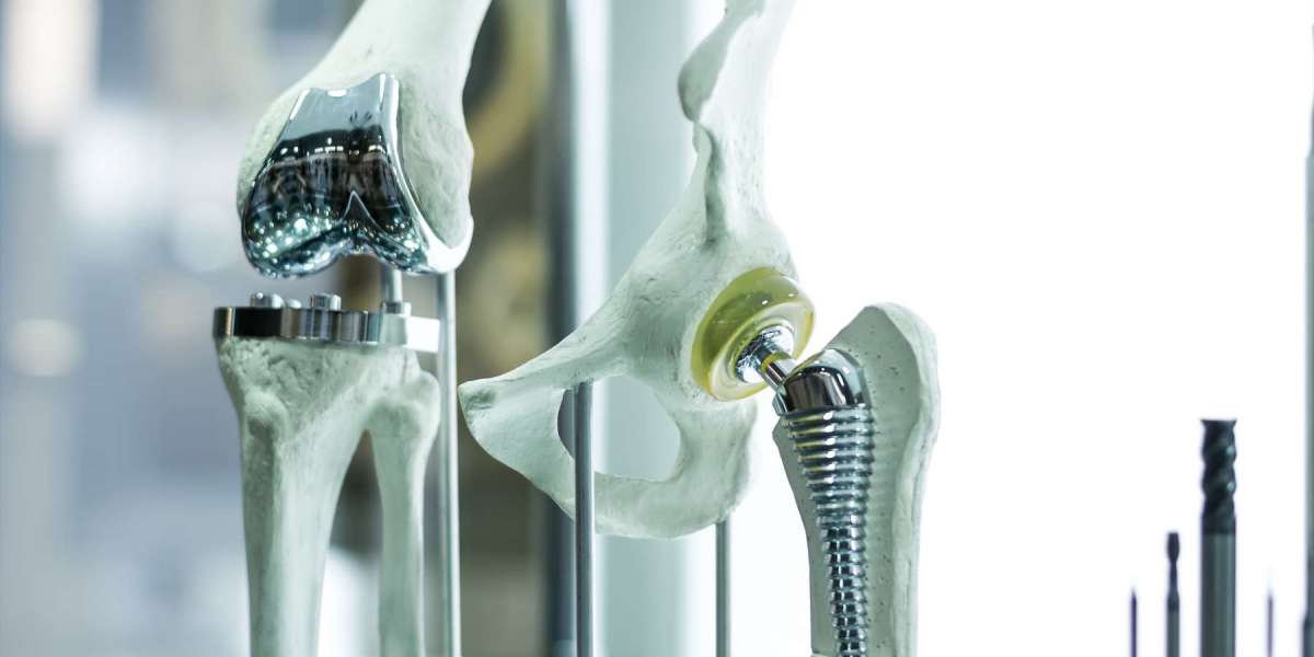 Enhancing Mobility: The Role of Biomaterials in Orthopedic Implants