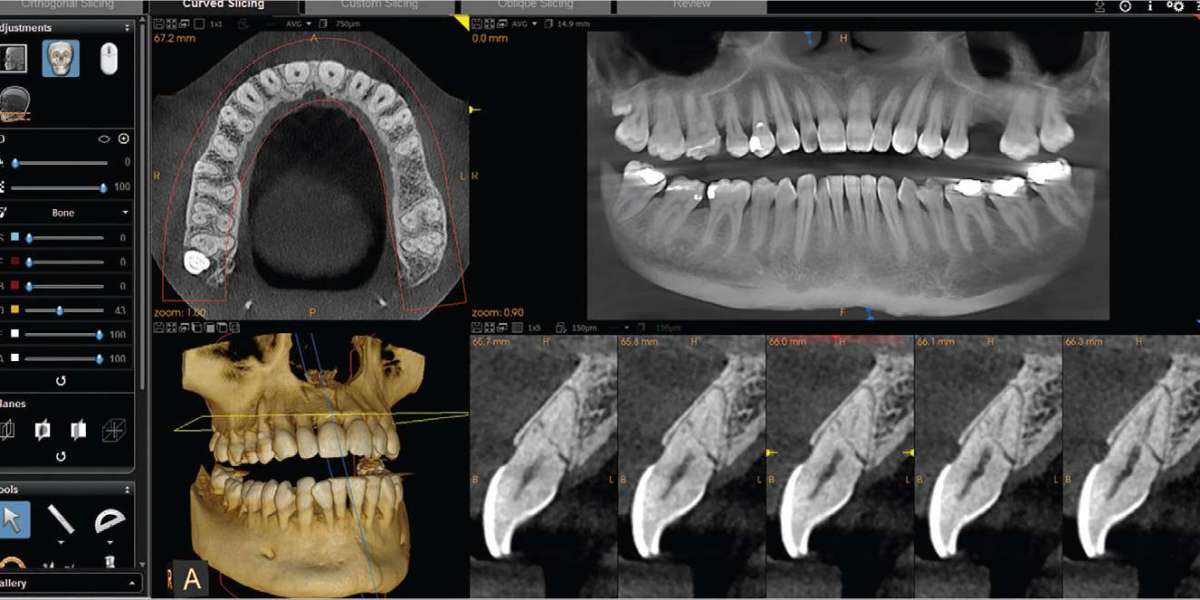 A Clearer Perspective: Enhancing Dental Imaging with 3D Cone Beam Technology