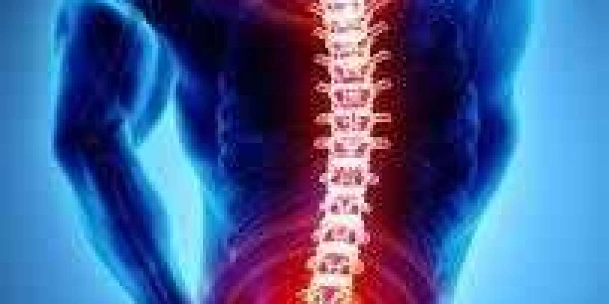 Effective Strategies for Relieving Severe Lower Back Pain