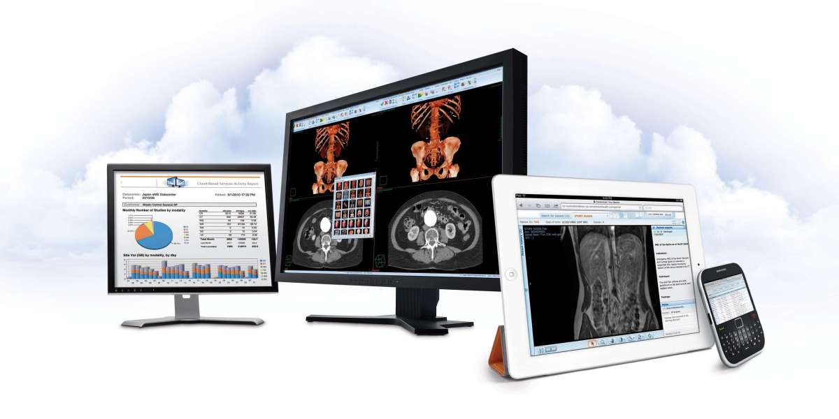 Clear Insights: Enhancing Diagnostic Accuracy with Radiology Monitors