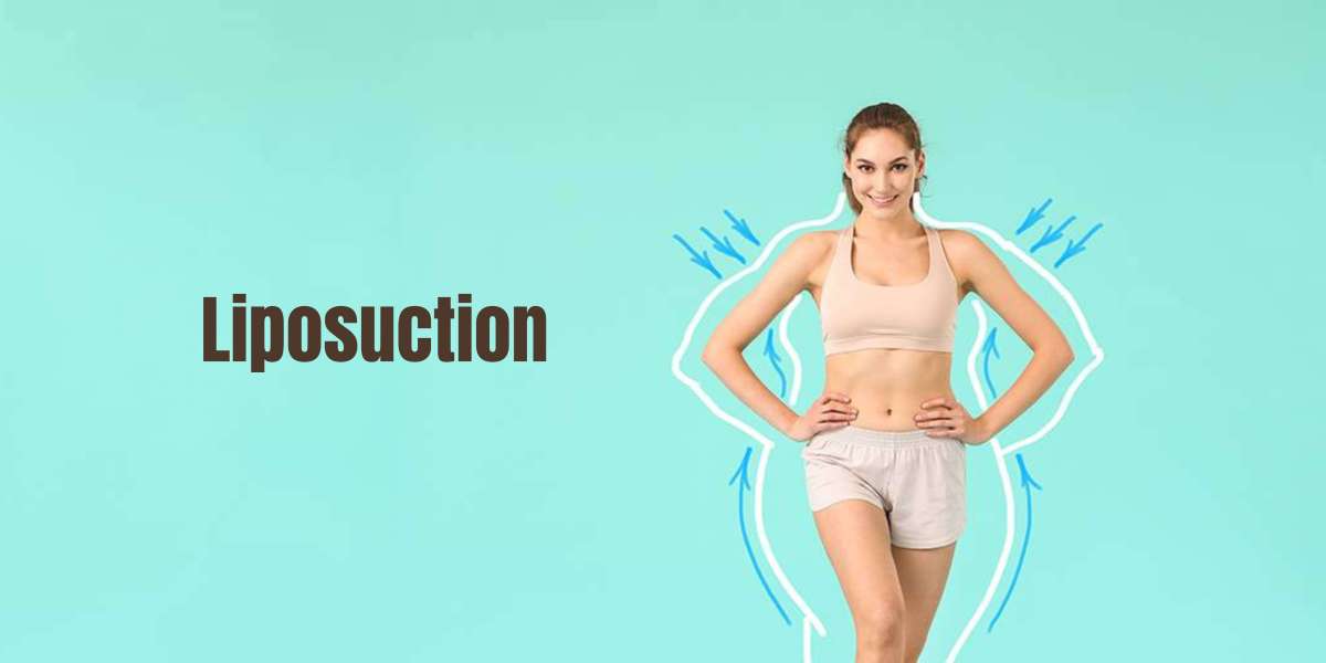 What Is Lower Body Liposuction In Females?