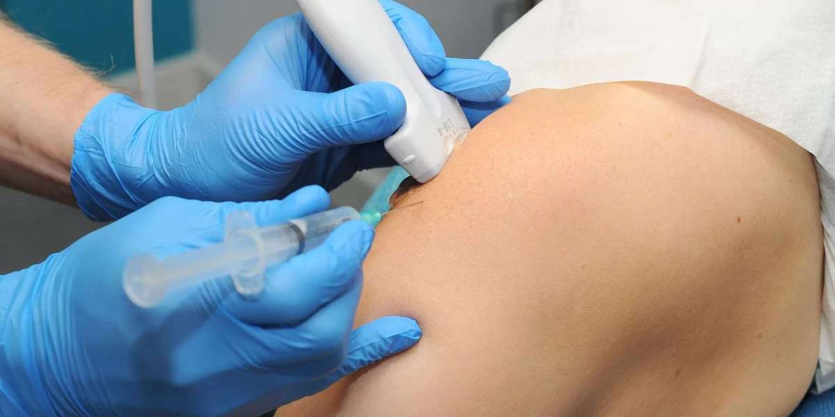 Understanding Cortisone Injections: Cost, Benefits, and Considerations