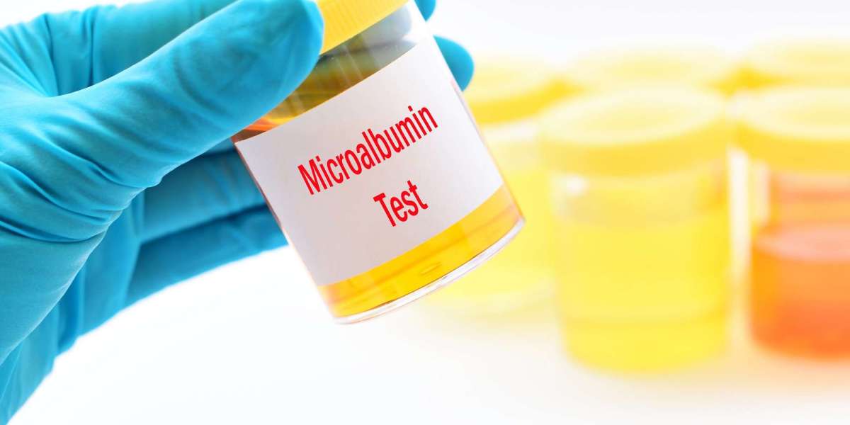 Beyond Standard Tests: How Microalbumin Testing Revolutionizes Kidney Diagnostics
