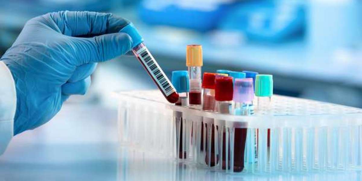 Precision and Excellence: The Best Pathology Lab in Ahmedabad