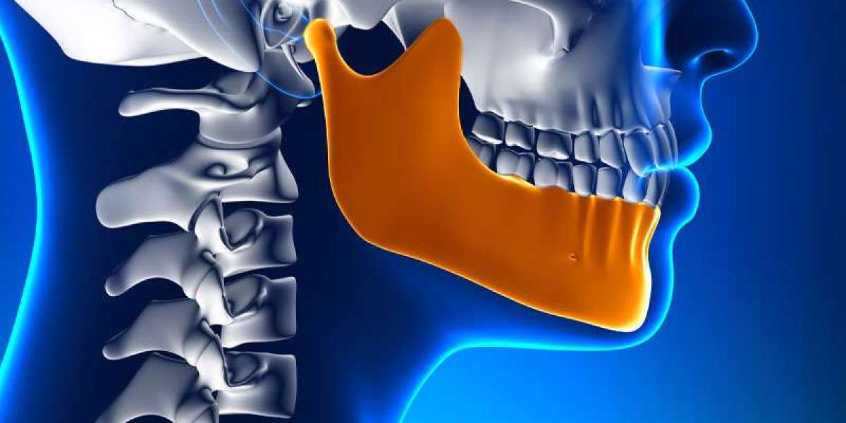 TMJ Implants Market Growth by Region (April 2024): Asia-Pacific, Europe, N. America & MEA