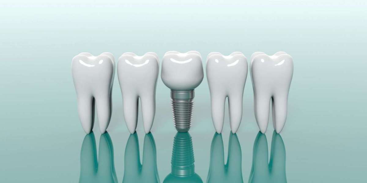 Beyond Fillings: Regenerative Dentistry Market Grows with Advanced Materials & Techniques
