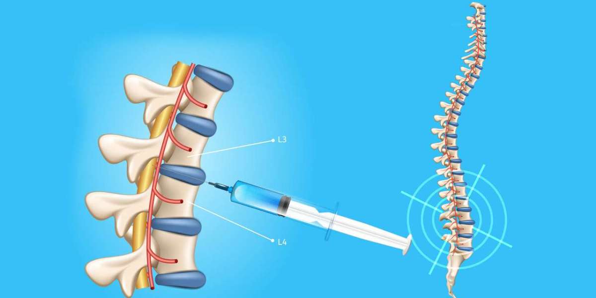 Less is More: Spinal Needles Facilitate Minimally Invasive Spine Procedures
