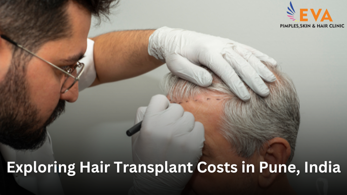 Hair Transplant Costs in Pune: A Complete Guide