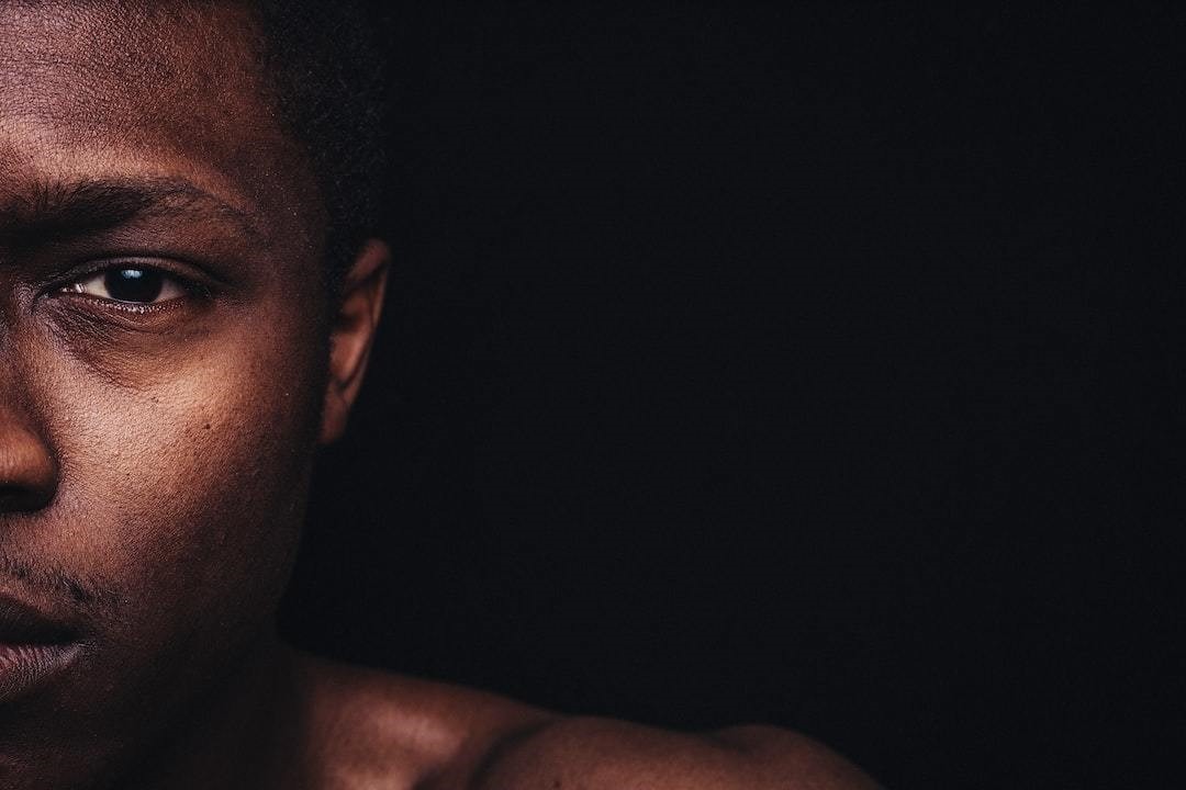 Black Skin: Dermatology and Key Skin Conditions Uncovered 