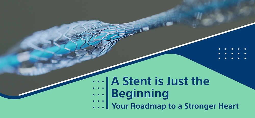 A Stent is Just the Beginning: Your Roadmap to a Stronger Heart