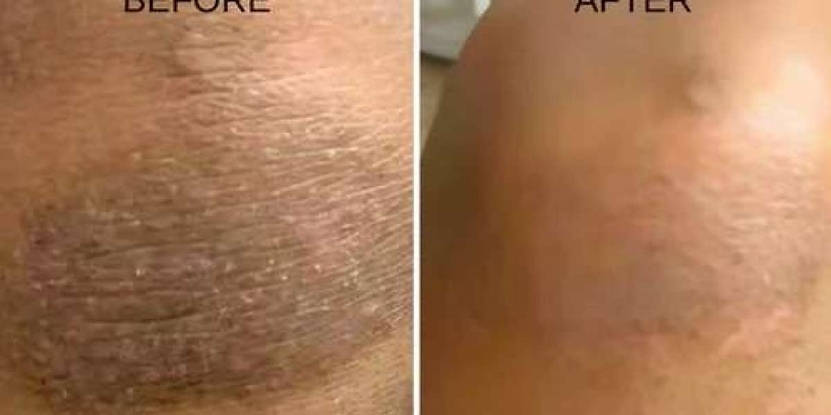 Discover the Power of Natural Body Creams Today