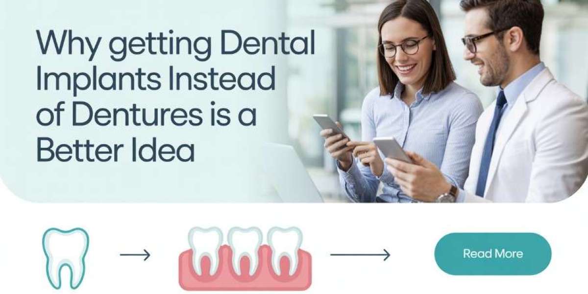Why getting dental implants instead of dentures is a better idea