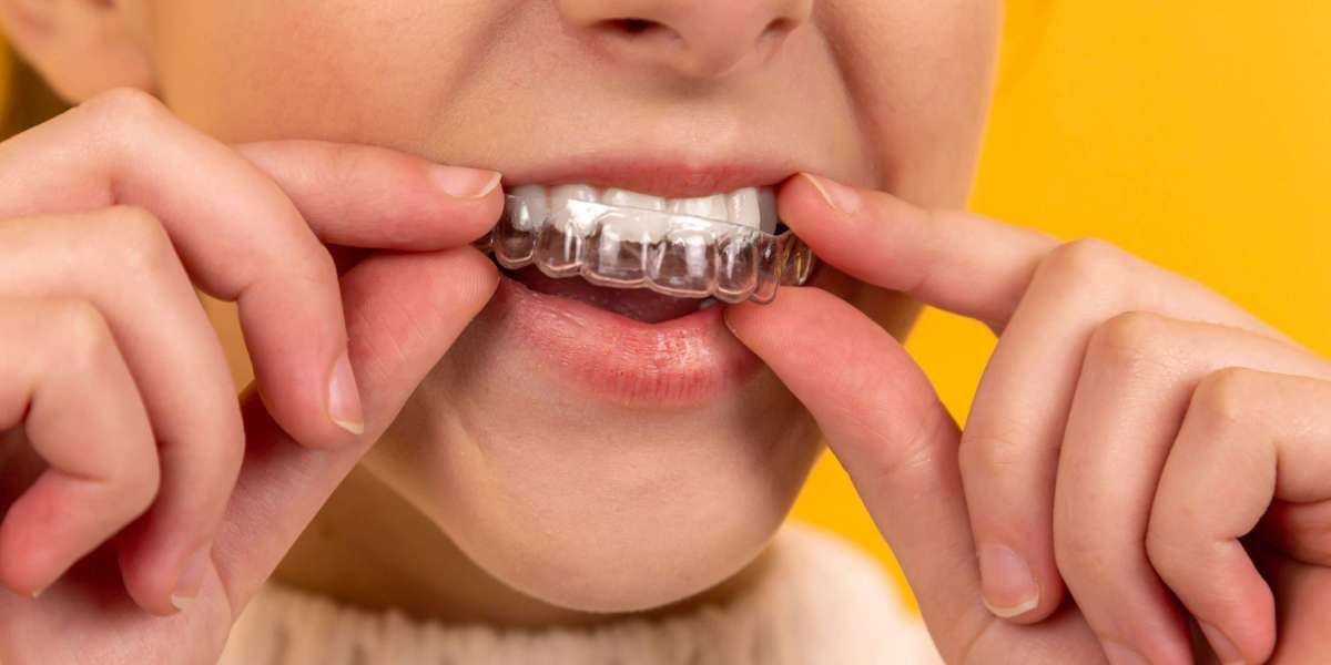 Restore Your Smile with Dental Implants on the Sunshine Coast