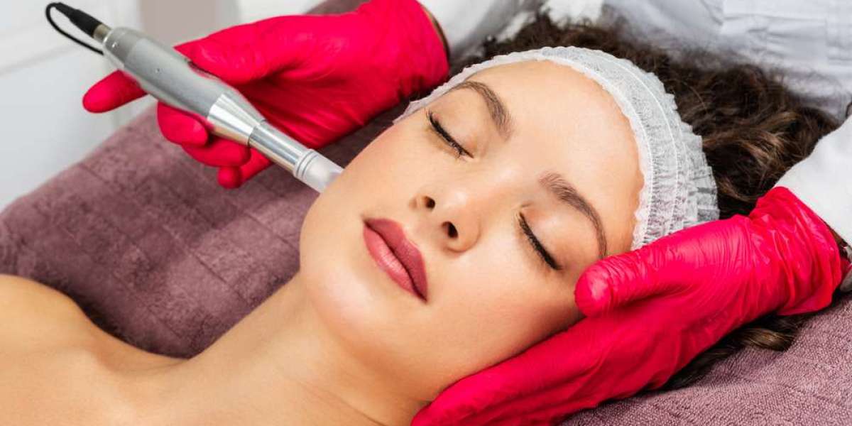 The Science Behind Microneedling in Islamabad: How It Transforms Your Skin