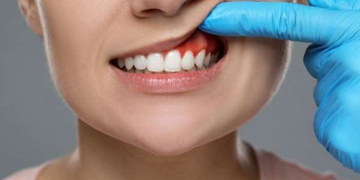 Managing Dental Pain the Right Way in Dover