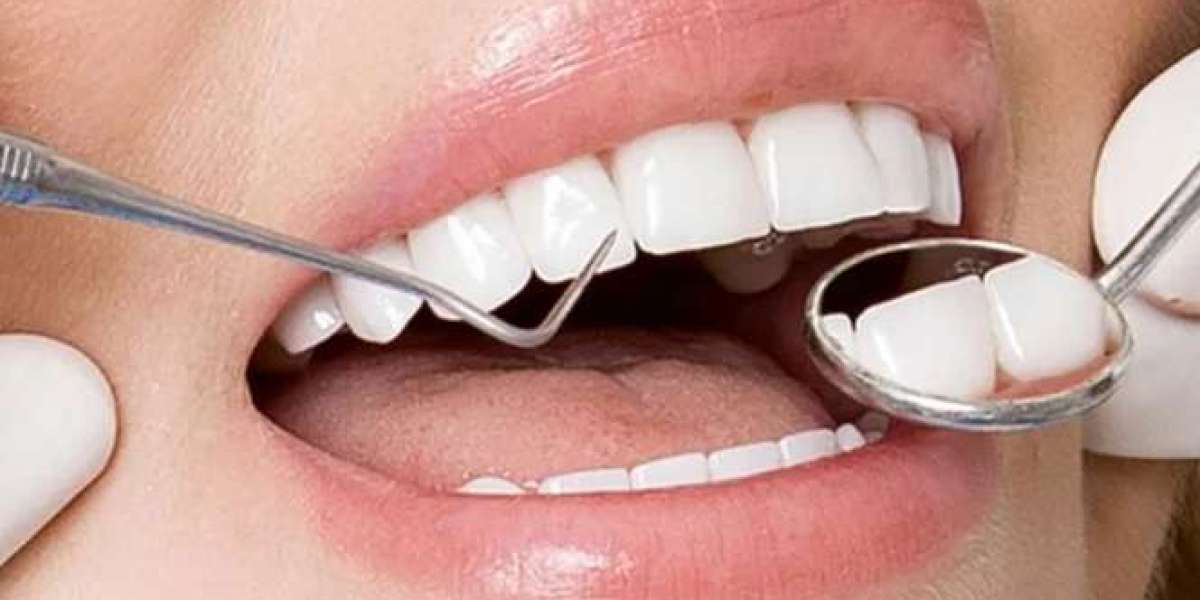 Mọc răng khôn có nên nhổ không? Chuyên gia giải đáp chi tiết