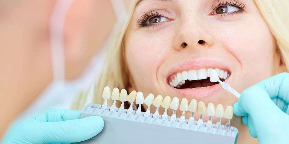 Transform Your Smile with Ellenbrook Cosmetic Experts