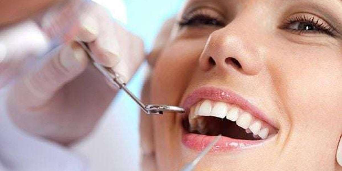 Trám răng sâu – Giải pháp đơn giản giúp bảo tồn răng thật hiệu quả