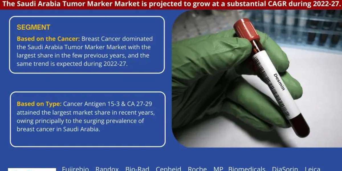 Saudi Arabia Tumor Market Forecast: Growth Drivers & Outlook to 2027