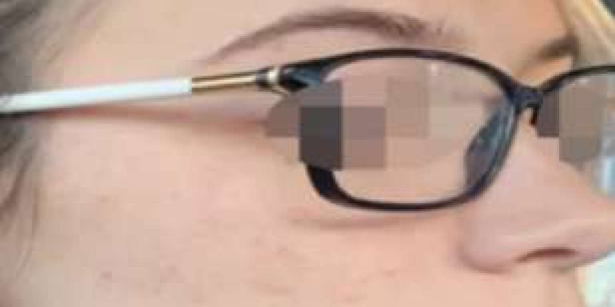 Reveal Firmer, Younger-Looking Skin with Skin Tightening Treatments