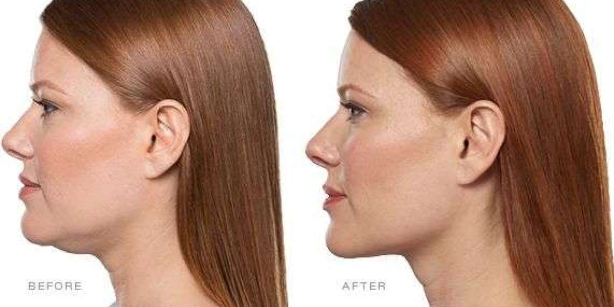 Discover the Permanent Solution to Jaw Misalignment