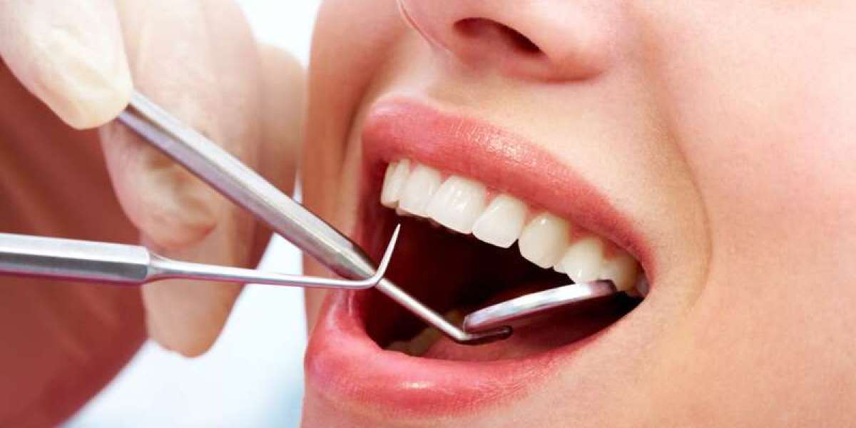 Sau khi nhổ răng khôn nên làm gì? Hướng dẫn hồi phục không biến chứng từ chuyên gia
