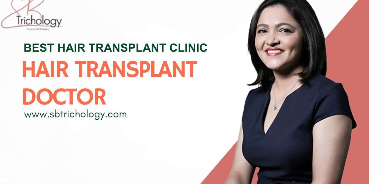 Thinking About a Hair Transplant? Ask These Questions First