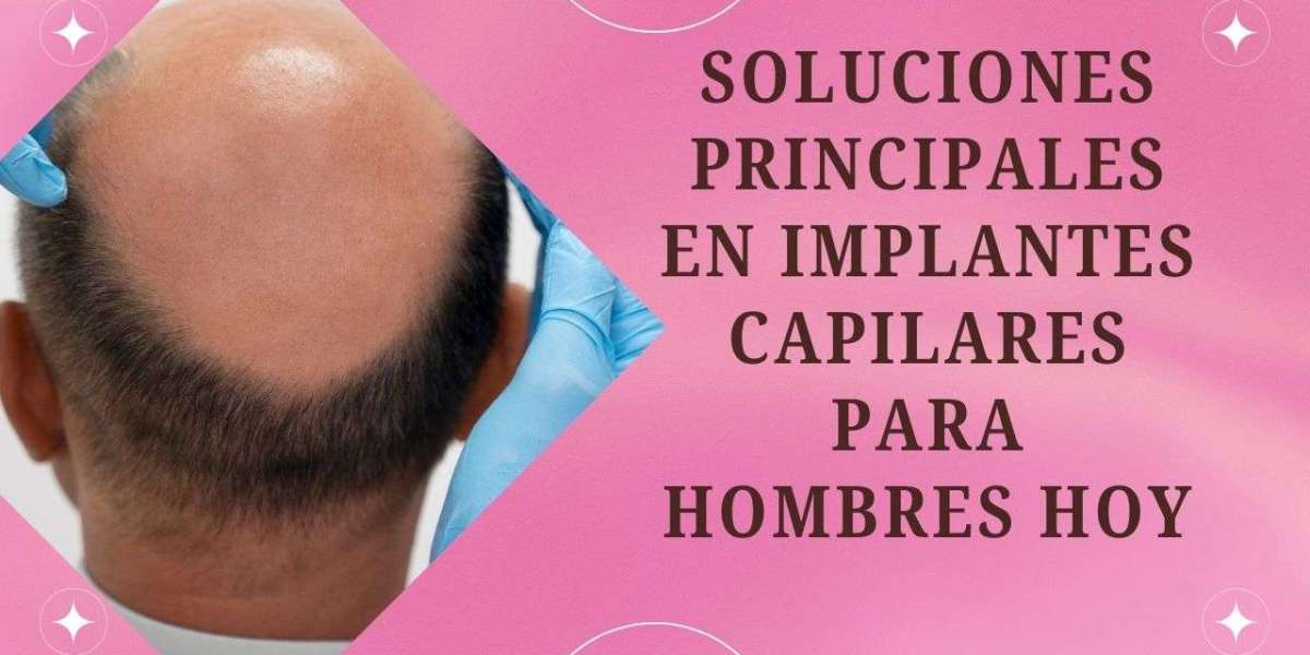 Soluciones Principales en Implantes Capilares para Hombres Hoy en Día