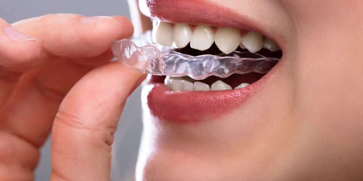 Clear Aligners for Teens and Adults Alike