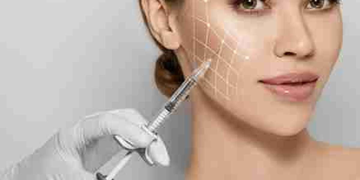 Using Fillers to Rejuvenate the Area Around the Mouth
