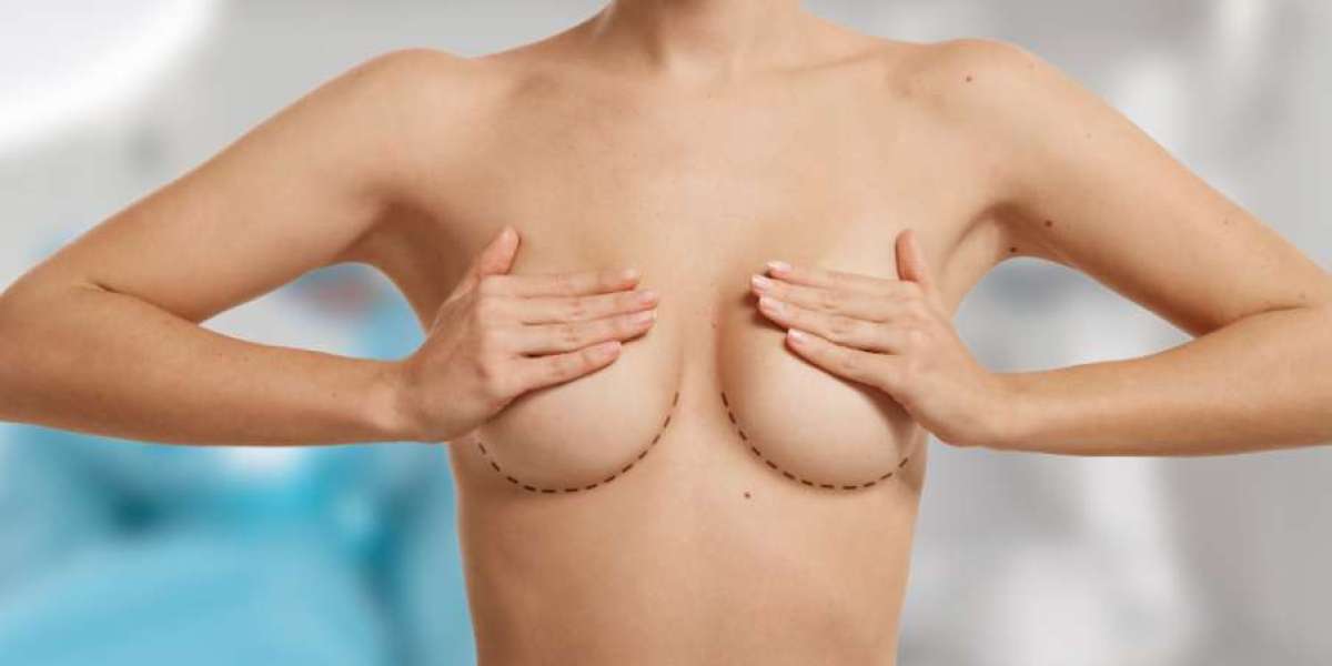 Considering Breast Augmentation Surgery? Know This Before You Plan It!