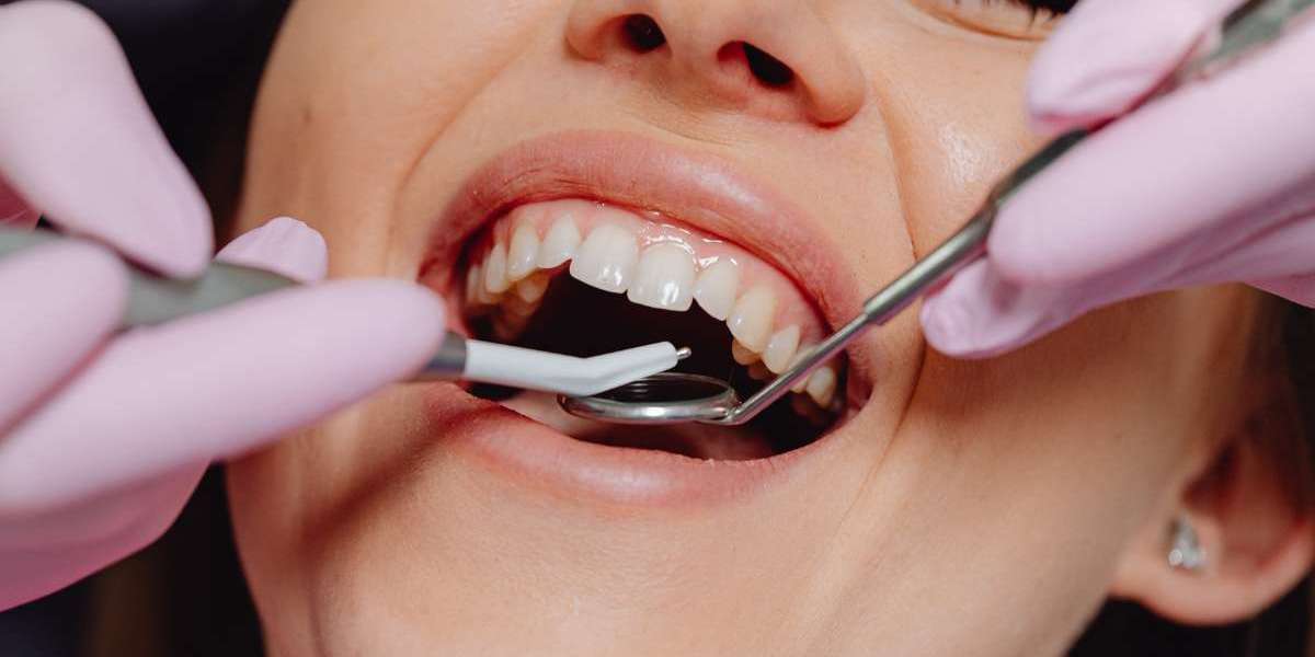 Choose Trusted Dental Care at Prudental Clinic in Kothrud, Pune