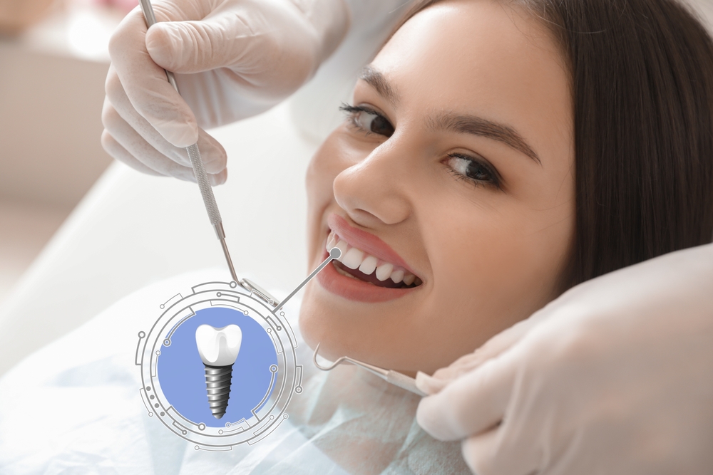 Dental Implants in Gota , Ahmedabad | New Smile Dental Clinic