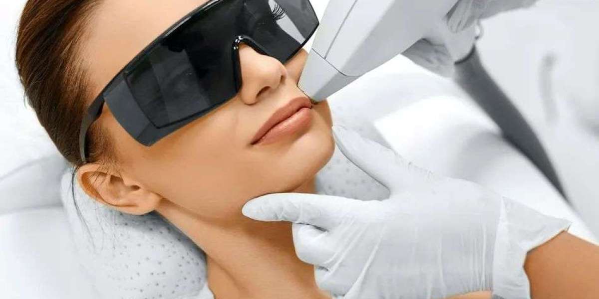 Laser Hair Reduction in Delhi – Expert Care at AAYNA Clinic
