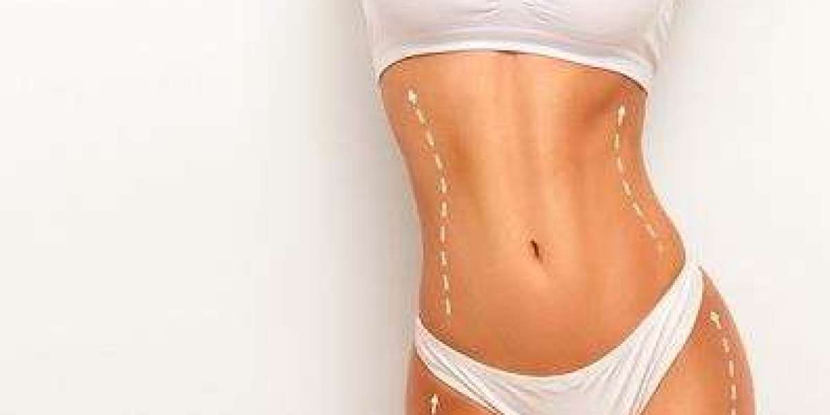 Slimming Drip Price in Pakistan: A Comprehensive Guide to Costs, Benefits, and Real Value