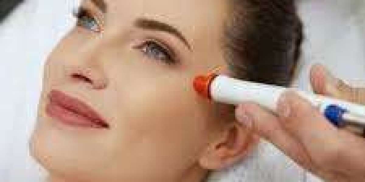 Restore Your Glow with Microneedling in Islamabad