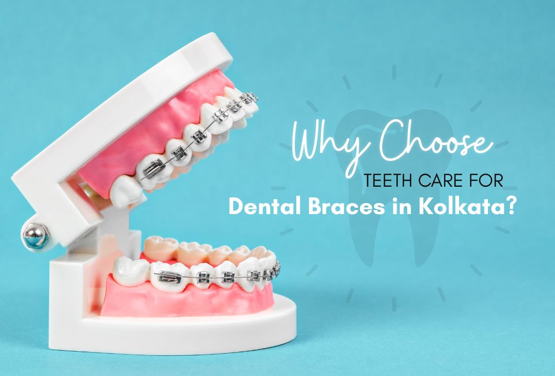 Why Teeth Care is the Best for Dental Braces in Kolkata? | Teethcare