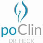 lipedema removal