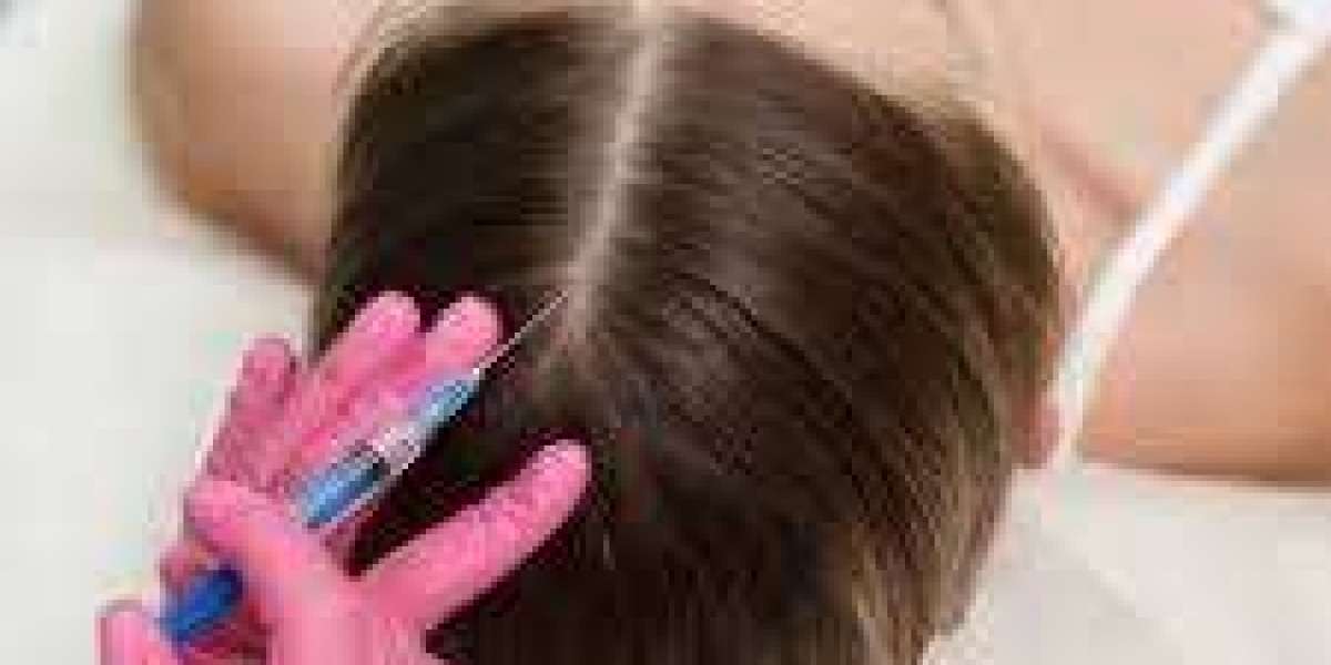 Best PRP Hair Treatment in Islamabad – Natural Hair Regrowth Solution