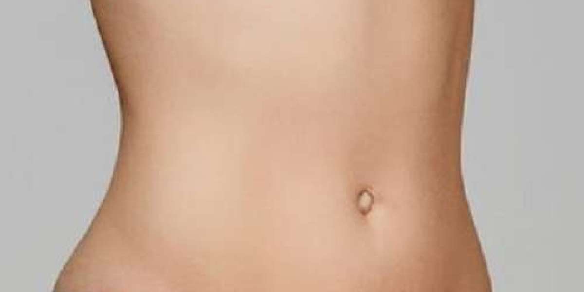 Liposuction in Islamabad: What to Expect from Start to Finish