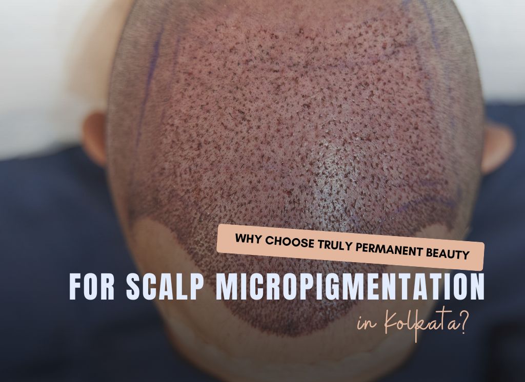 Why us for Scalp Micropigmentation in Kolkata?