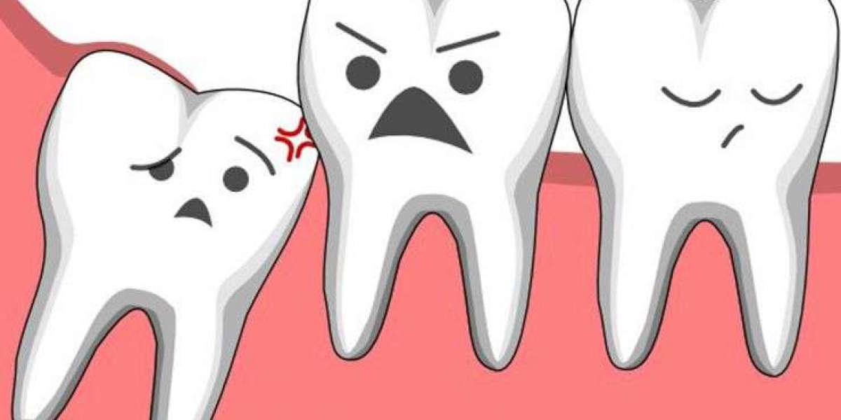 Sau khi nhổ răng khôn nên làm gì? Hướng dẫn chăm sóc chuẩn giúp mau lành và không đau