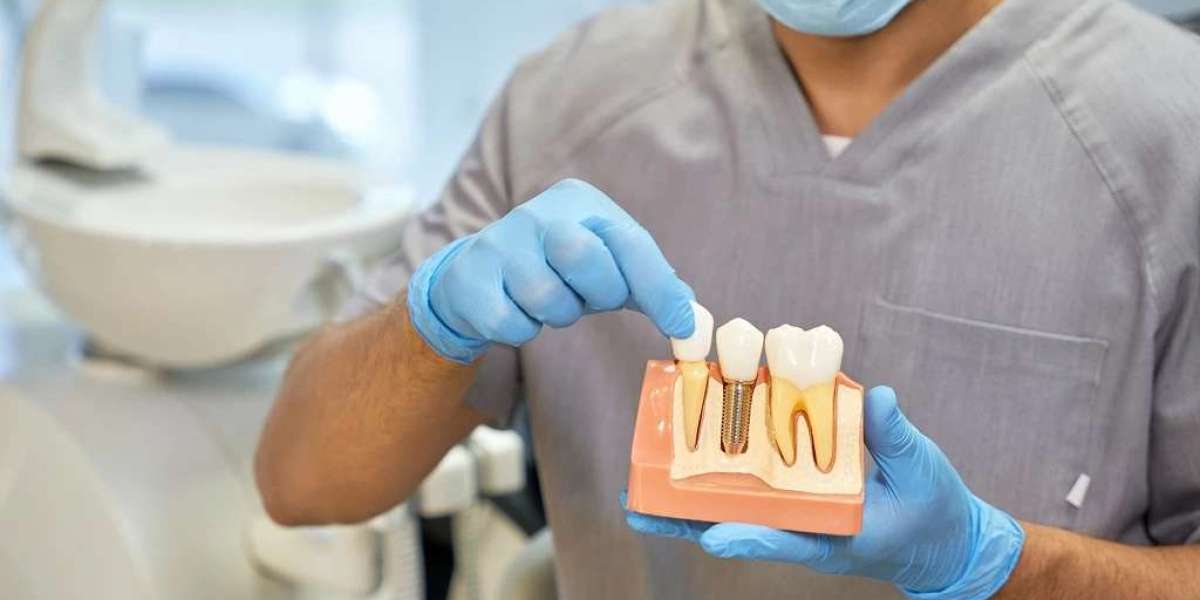 Get back Your own Self-confidence along with Inexpensive Dental Implants in Darwin
