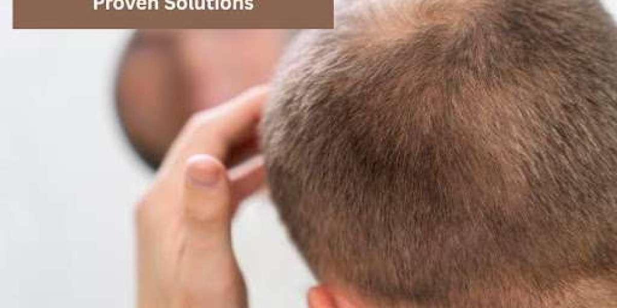 Top Medicine for Hair Loss Male – Regain Confidence with Proven Solutions
