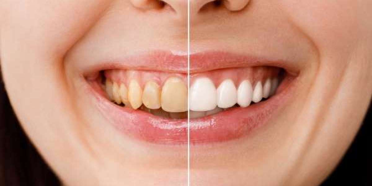 Làm thế nào để nhận biết một nha khoa uy tín giữa hàng trăm lựa chọn hiện nay?