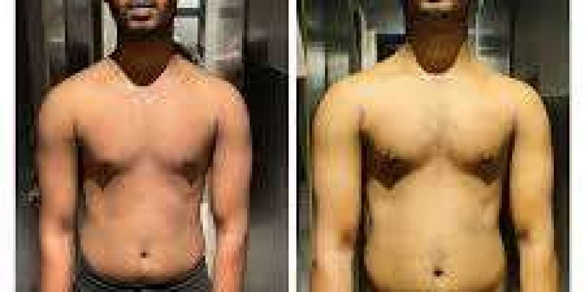 Understanding Weight Gain Calculation for a Healthier Journey