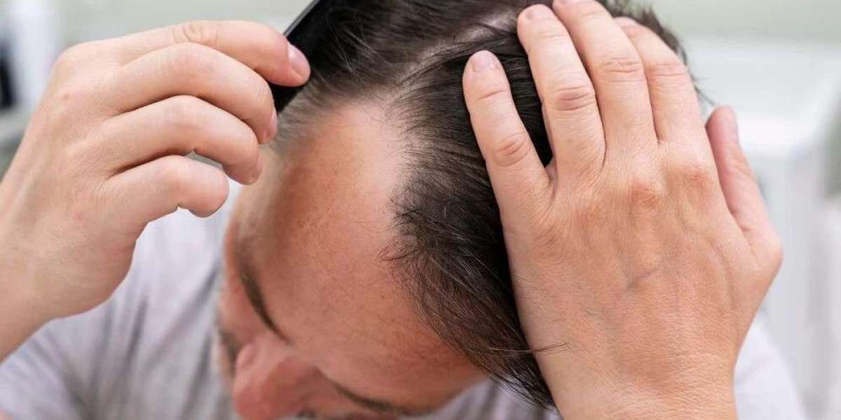 When Can You Start Styling Your New Hair?